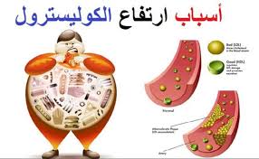 اسباب ارتفاع الكوليسترول